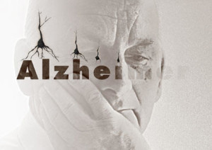 Neurologi-italiani-scoprono-meccanismo-della-nascita-dell-Alzheimer