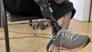 Prima-protesi-alla-gamba-sensibile-realizzata-in-Austria 