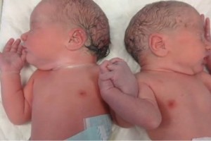 Australia-la-foto-dei-gemelli-nati-prematuri-che-si-tengono-per-mano-commuove-il-mondo