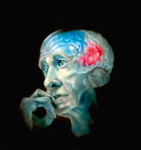 Alzheimer-un-team-italiano-ha-scoperto-come-e-dove-sorge-la-malattia