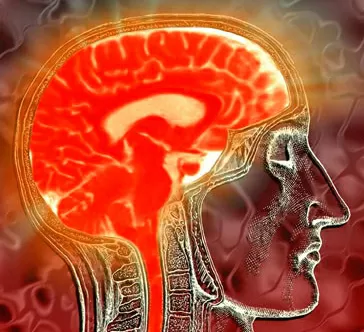 Il-“mini-cervello”-in-3D-è-realtà-creato-in-laboratorio
