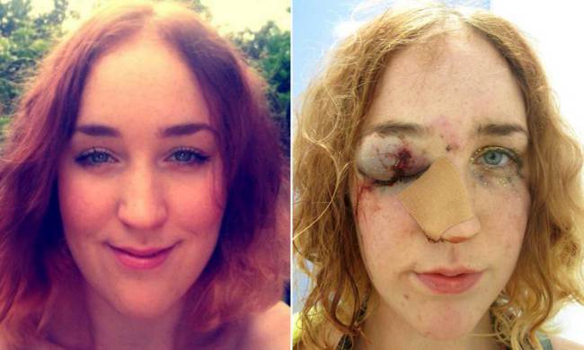 Londra-ragazza-pestata-a-sangue-per-aver-respinto-le-avance-di-un-uomo