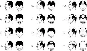 Mai-più-calvi-un-farmaco-rivoluzionario-assicura-la-ricrescita-dei-capelli