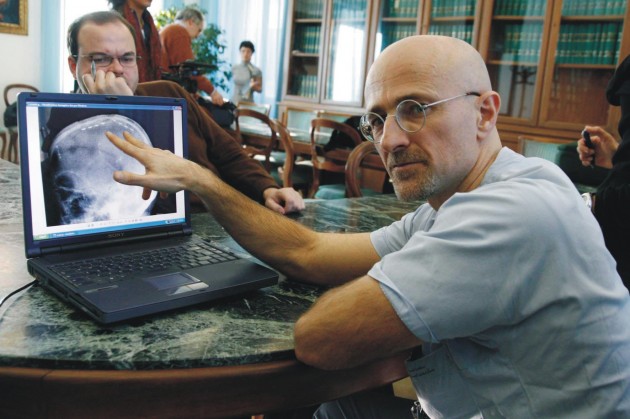 Trapianto-di-testa-pubblicate-nuove-ricerche-del-neurologo-Sergio-Canavero