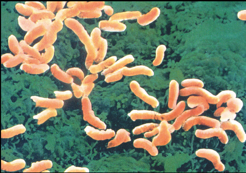 Il batterio dell’ulcera l’Helicobacter può determinare l’infarto STEMI