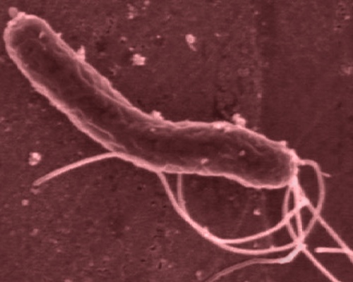 Helicobacter pylori procura non solo l’ulcera ma anche l’infarto