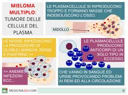 Mieloma-multiplo-nuova-cura-combinata-di-farmaci-e-trapianto-fa-raddoppiare-la-sopravvivenza