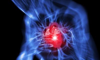 Acido urico presente nel sangue può provocare l’infarto