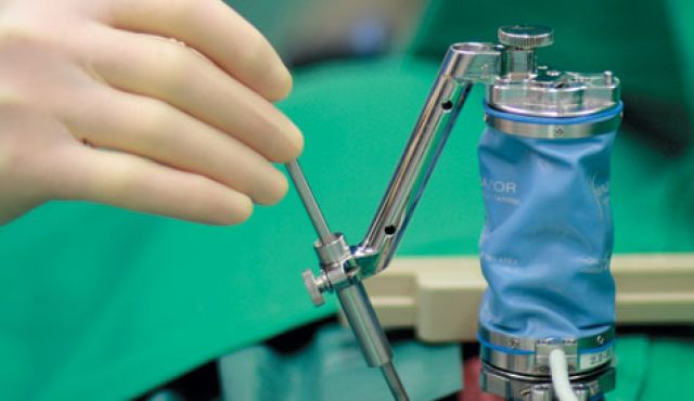 Torino-robot-Mazor-utilizzato-per-trapianto-midollo-spinale
