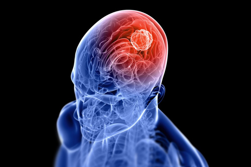 La-stupidità-scoperto-il-virus-che-può-provocare-l-insorgenza