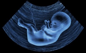 Malattie-prenatali-la-super-amniocentesi-individua-gran-parte-patologie