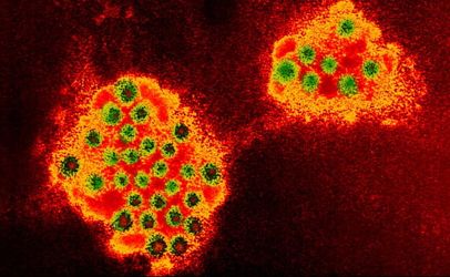 Norovirus scoperto come si riproduce virus che provoca gastroenterite