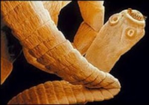 Regno-Unito-un-uomo-ha-vissuto-quattro-anni-con-un-verme-nel-cervello