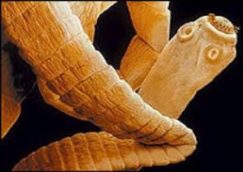 Regno-Unito-un-uomo-ha-vissuto-quattro-anni-con-un-verme-nel-cervello