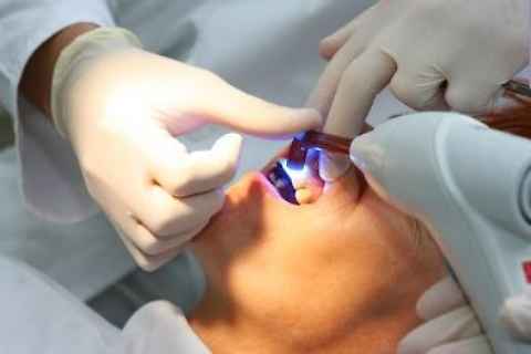 Parodontite-un-solo-dente-se-non-lavato-può-ospitare-1-miliardo-di-batteri