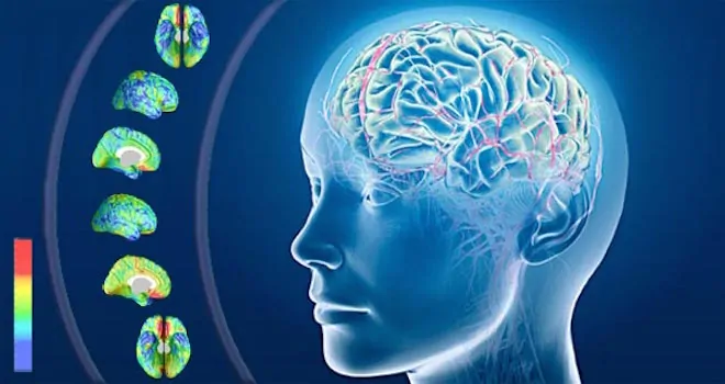 Alzheimer-scoperta-causa-malattia-possibilità-di-nuova-cura