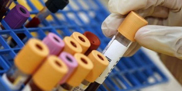 Tumore ovarico un test del sangue permette la diagnosi precoce