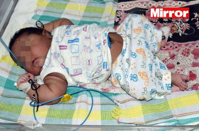 India, parto da record è nato il bambino più pesante del paese