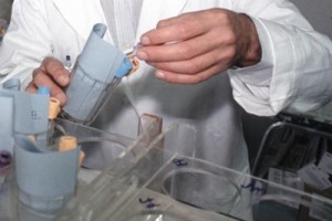 Sesso-orale-aumenta-il-rischio-di-tumori-al-collo-e-alla-testa