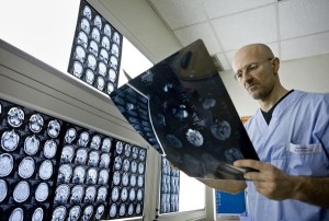 Trapianto-di-testa-riuscito-da-un-medico-italiano-ad-una-scimmia-nel-2017-sull-uomo