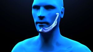 A-Padova-svolto-il-primo-trapianto-ad-mandibola-artificiale