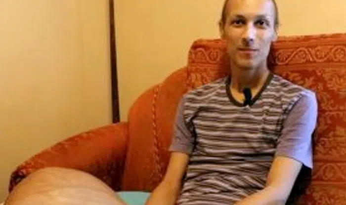 Luca Cardillo affetto da un tumore osseo inoperabile, ha una nuova speranza, dal 6 novembre sarà curato negli Usa