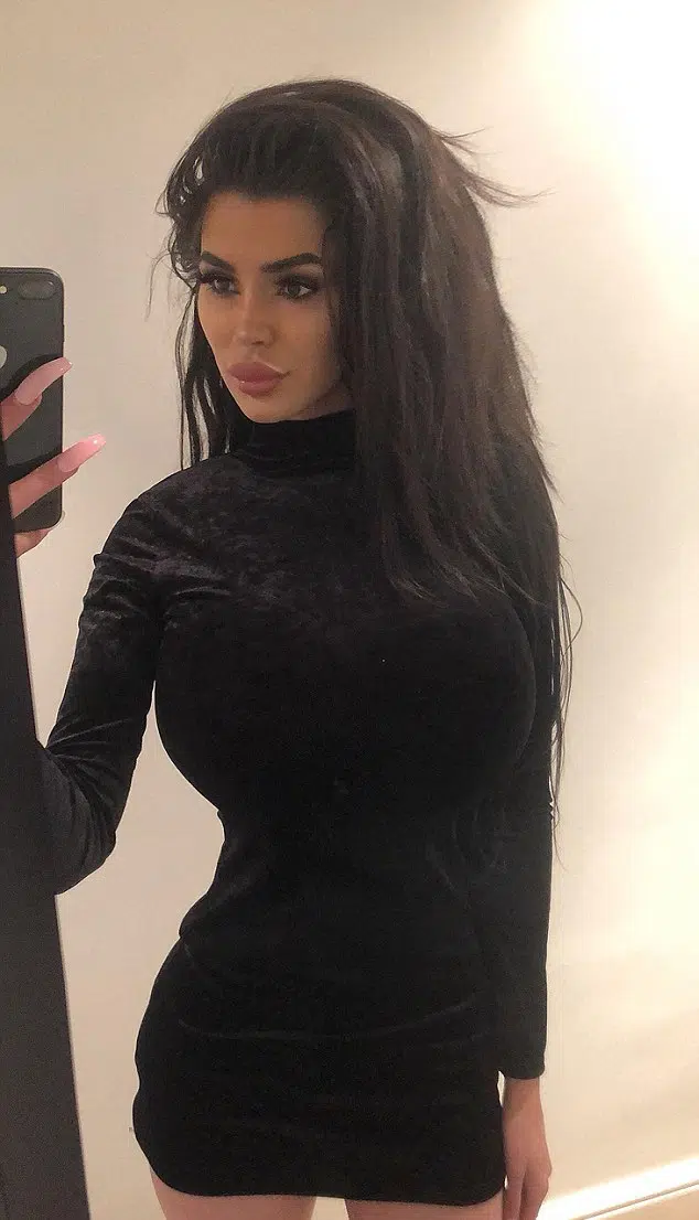 Giovane ragazzo 19enne vuole essere come Kim Kardashian spende oltre 15 mila euro in interventi