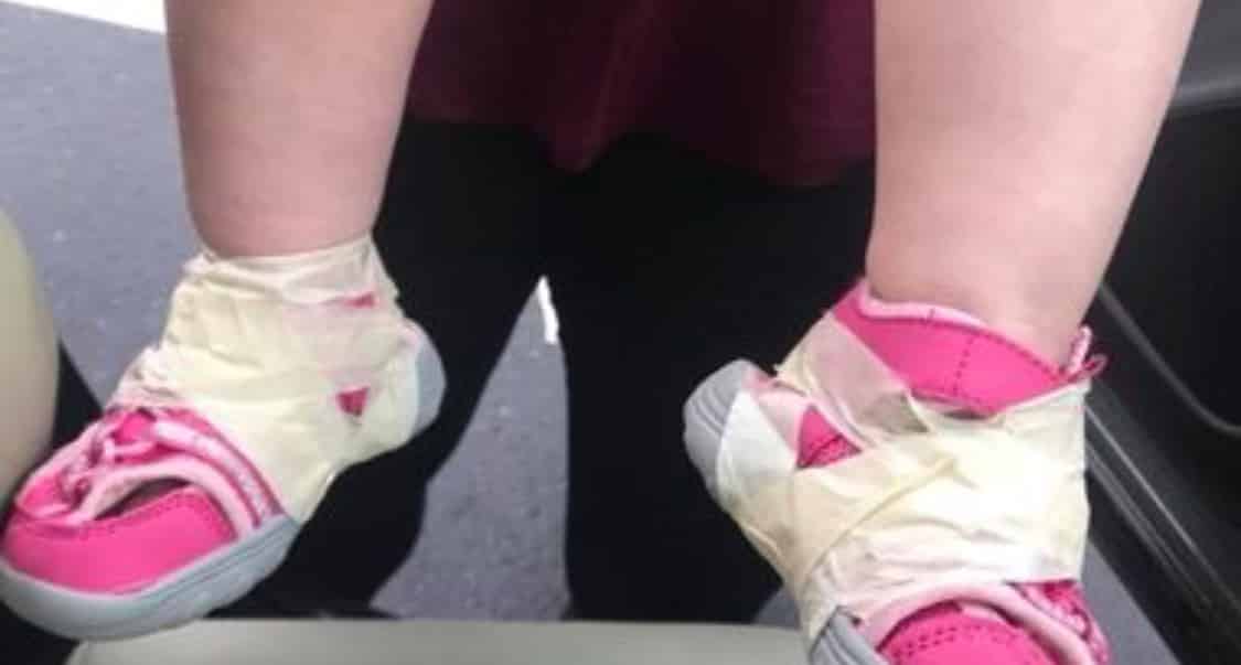 Due maestre decidono di bloccare i piedi di una bambina di 17 mesi, con il mastro adesivo, il motivo per cui lo facevano è assurdo