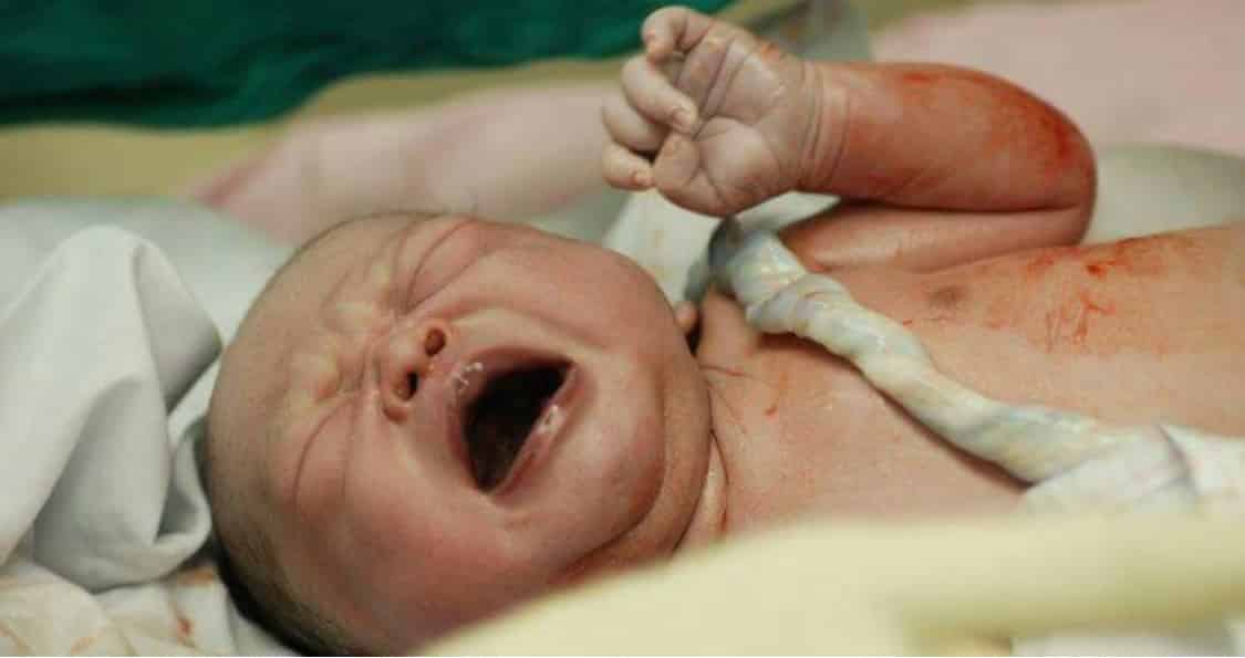 I medici pensano di aver fatto nascere un bambino sano, poi vedono il cordone ombelicale e nella sala parto cala il gelo