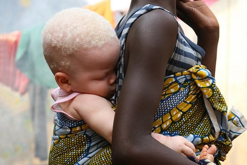 Coppia di nigeriani di colore mette al mondo bambino bianco, papà su tutte le furie, interviene il dottore e spiega cosa è accaduto