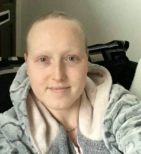 Ragazza di 28 anni dopo essere stata operata per un tumore molto aggressivo e poi sottoposta a lunghi cicli di chemioterapia scopre che i medici avevano sbagliato la diagnosi, non aveva alcun tumore
