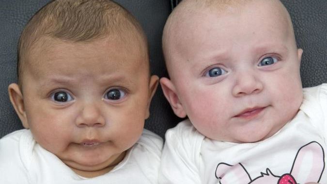 Nati due gemelli diversi, uno con i capelli lisci, l’altro con i capelli ricci, genitori decidono di fare la prova del DNA e si scopre che i bimbi hanno due papà