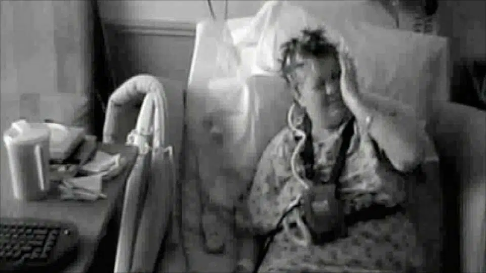 55enne soffre della Sindrome della mano aliena cose le succede è pazzesco
