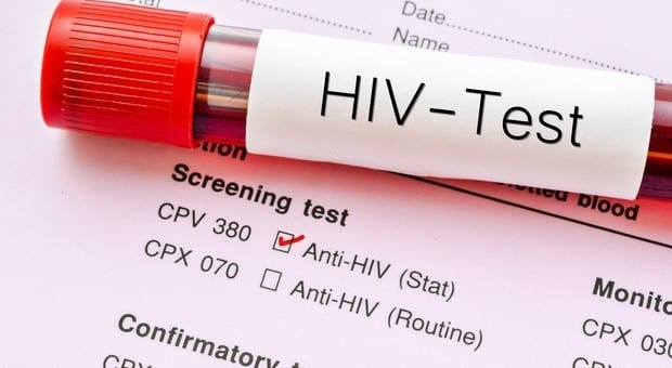 Allarme hiv , dopo 19 anni è stato scoperto un nuovo ceppo