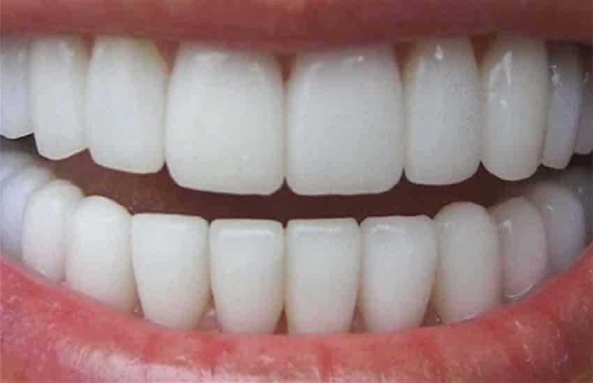 I problemi ai denti possono provocare problemi al cuore