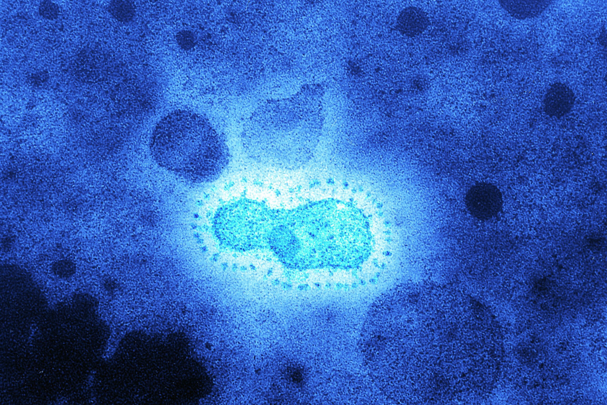 Emergenza COVID-19, noto virologo italiano docente in Usa è ottimista “In Italia continua la grande ritirata del Coronavirus, presto torneremo alla normalità”