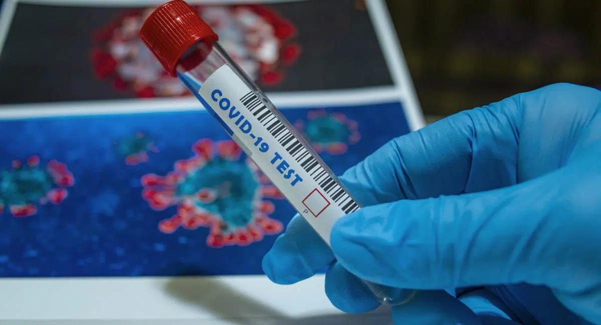 Emergenza Covid-19, virologo di fama internazionale “Il virus circola ancora, una seconda ondata non è un ipotesi ma una certezza”