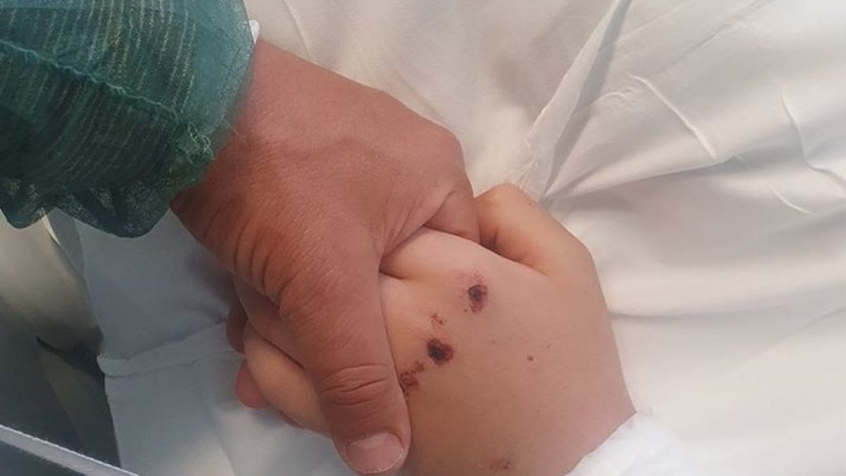 Puglia, 15enne esce dal coma dopo essere stato investito mentre era in bici, il padre pubblica una foto delle loro mani che si stringono “Mai gioia più grande, amore di papà”