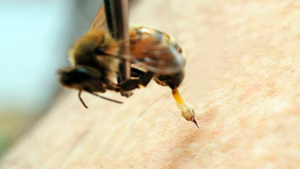 Donna di 44 anni viene punta al piede da un insetto, ricoverata muore dopo alcuni giorni