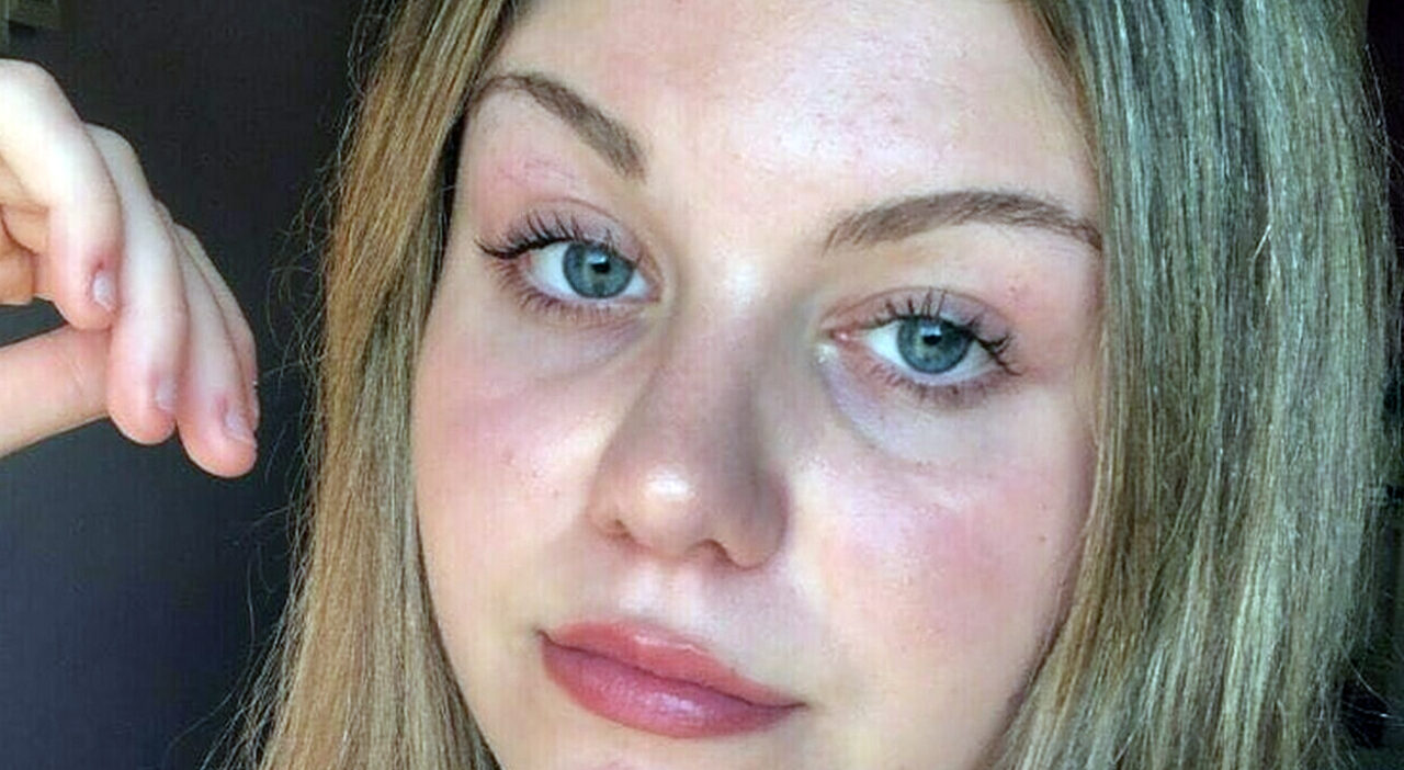 La ragazza di Castelguglielmo colpita da una malattia autoimmune dopo un malore in treno. I genitori scelgono la donazione degli organi.